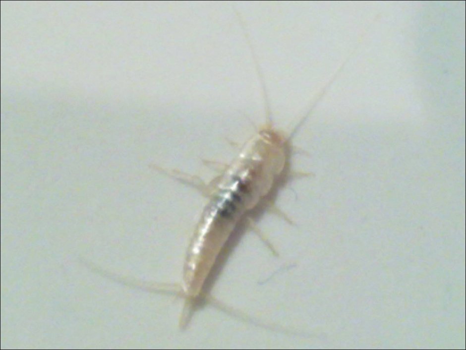 Чешуйница (lepisma saccharina)