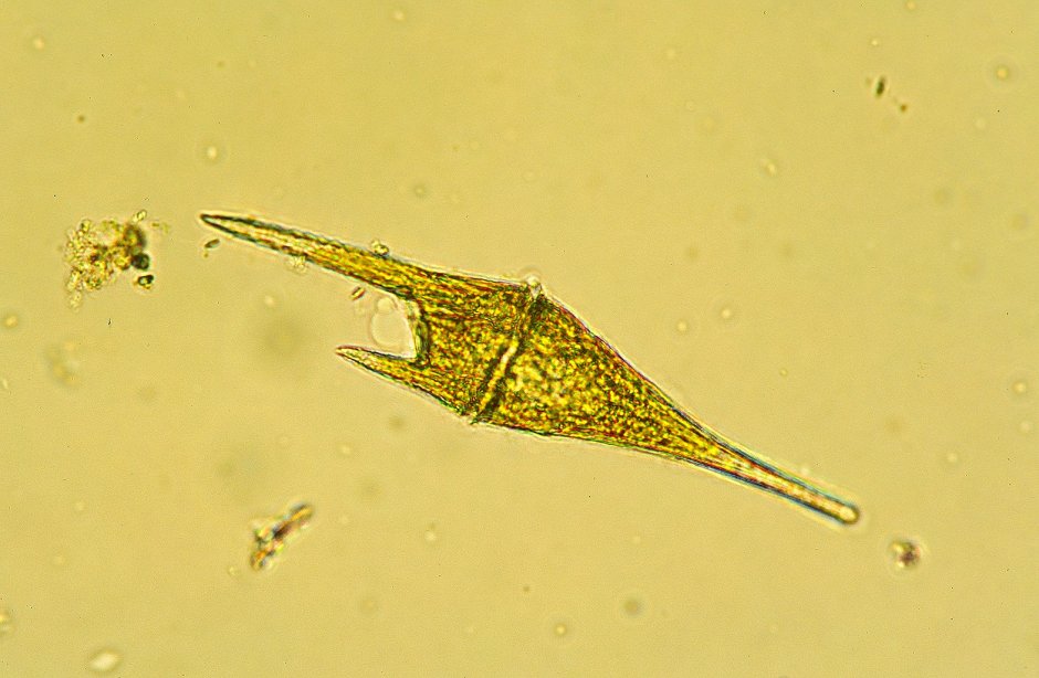Ceratium hirundinella