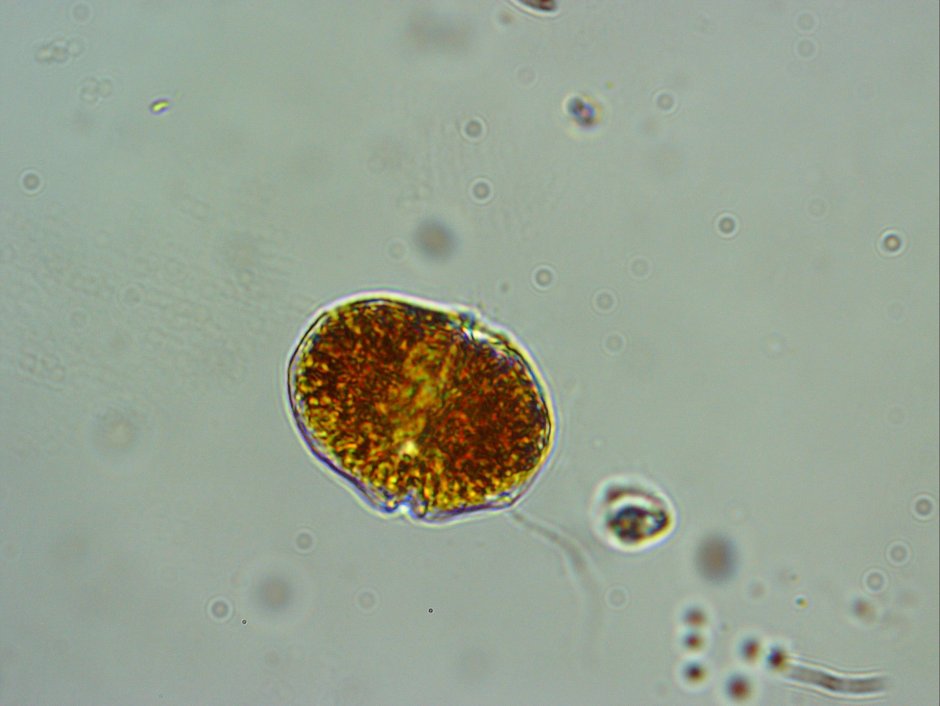 Peridinium Tabulatum