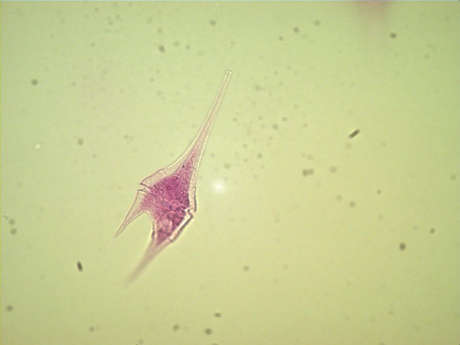 Динофлагелляты водоросли