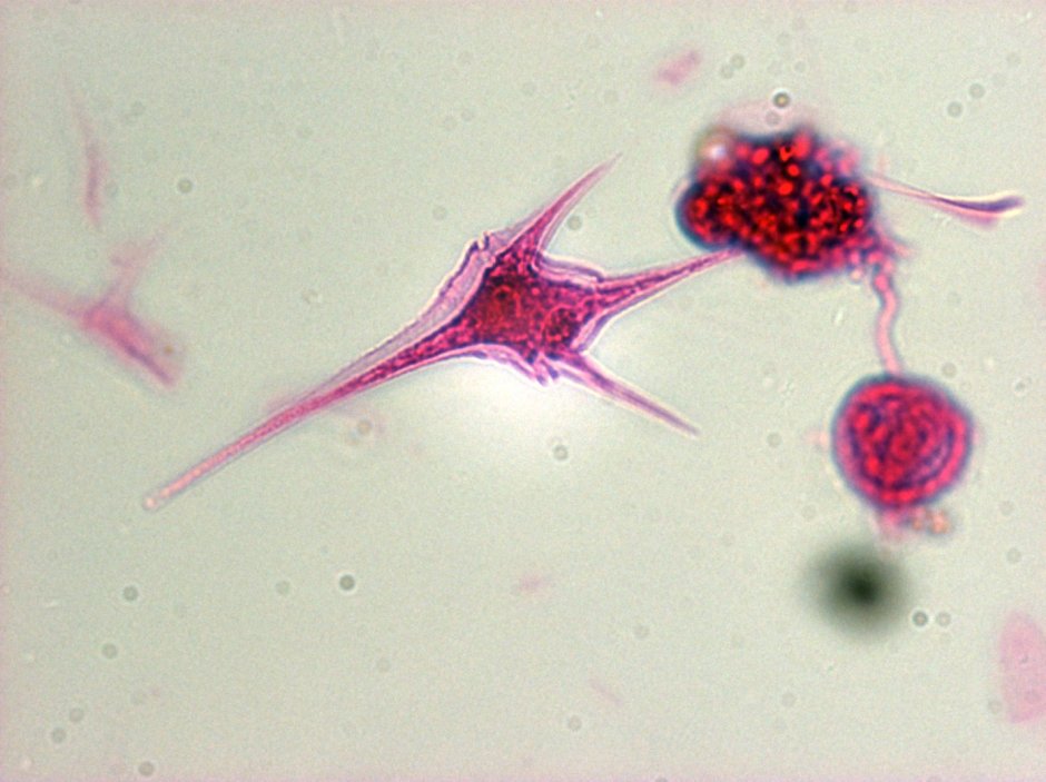 Жгутиконосцы цератиум